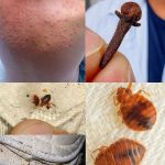 How to quickly get rid of bed bugs, cockroaches, fruit flies and other insects from our…see more